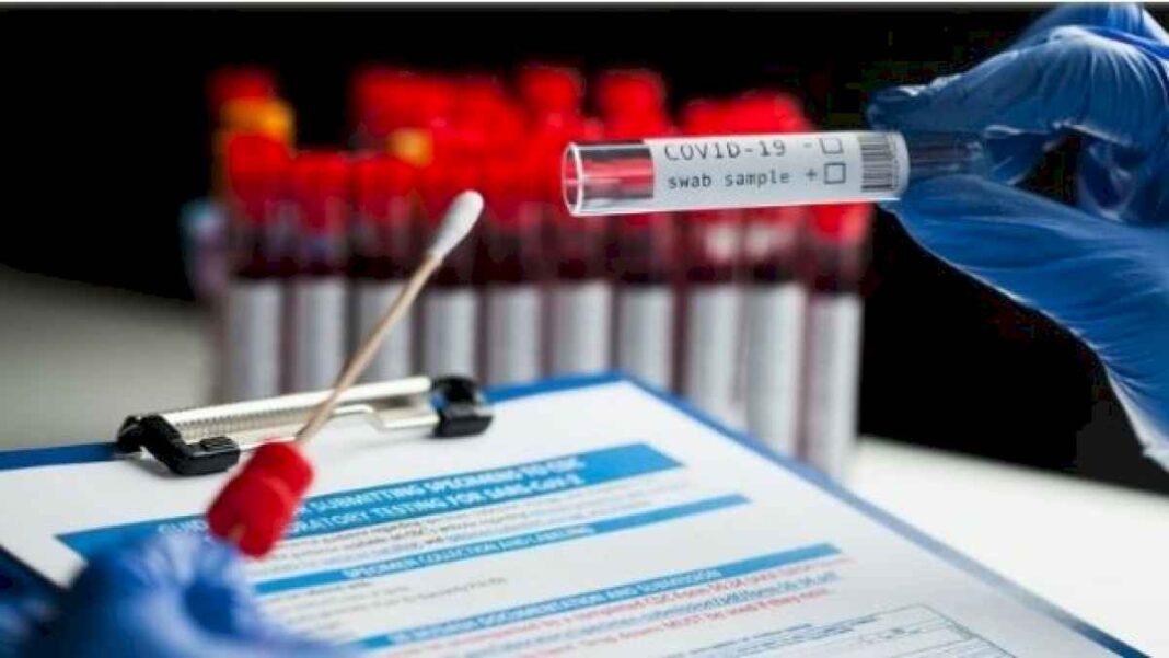 coronavirus-en-argentina:-confirman-1.329-casos-nuevos-y-12-fallecidos