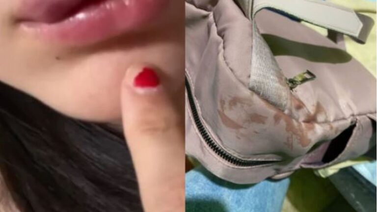 Un instructor de Taekwondo sometió a una brutal agresión a su expareja