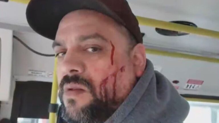 Moreno: quisieron viajar con un certificado trucho y le desfiguraron la cara a un colectivero